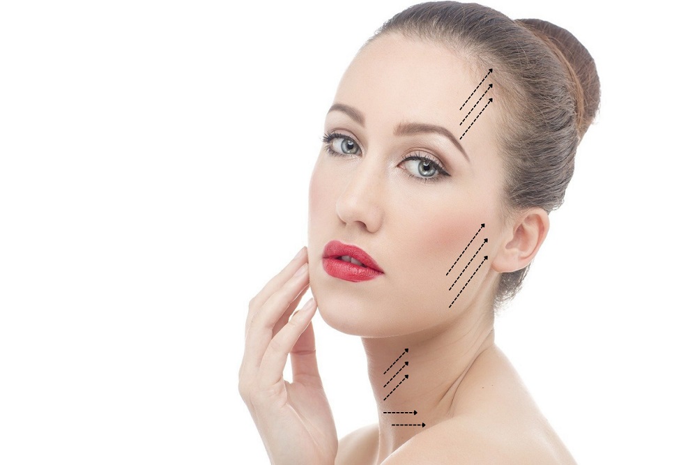 RHYTIDECTOMY (FACE LIFT)